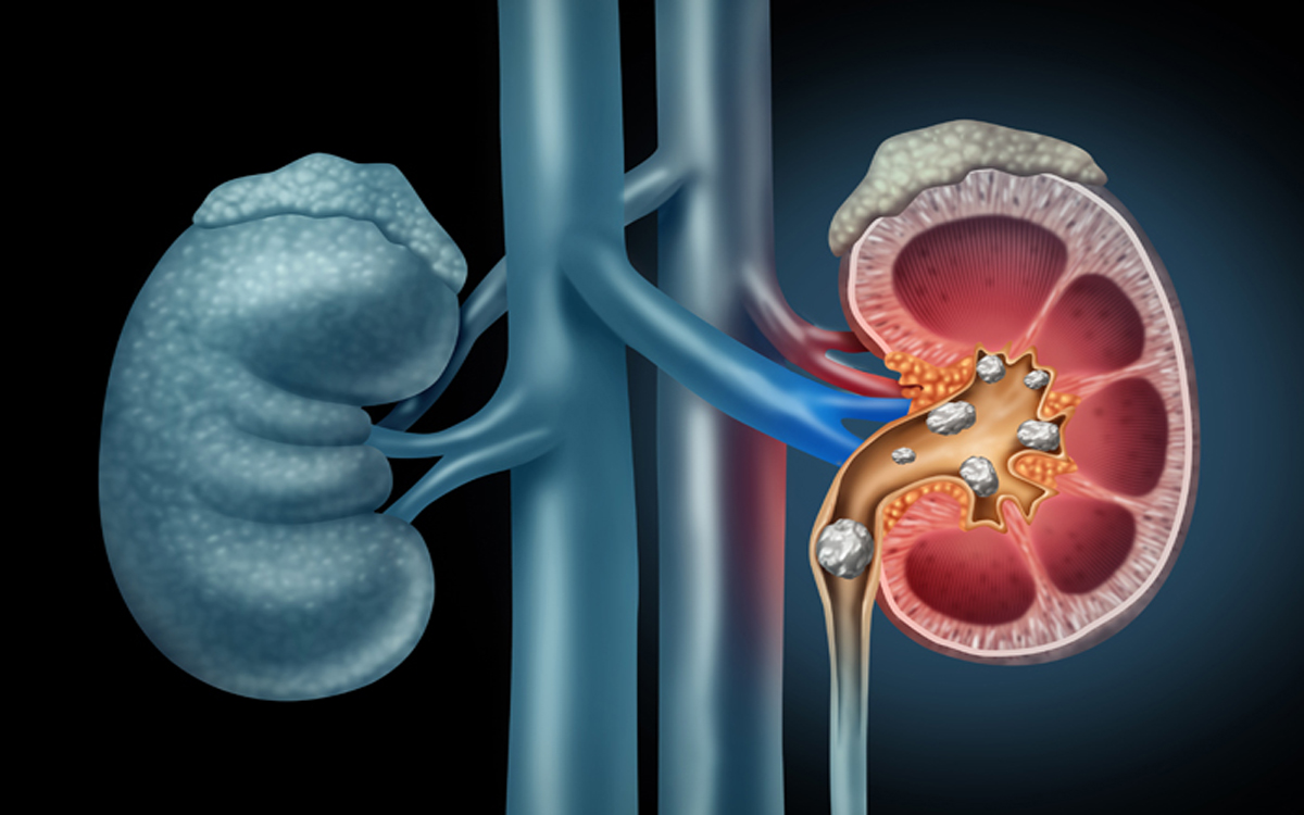 UROLOGY